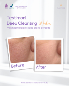 Slide 4 Deep Cleansing Water